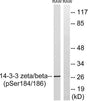 14-3-3 β/ζ (phospho Ser184/186) rabbit pAb