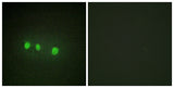 Zic1/2/3/4/5 rabbit pAb 50µL/100µL