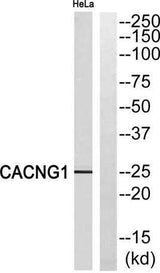 L-type Ca++ CP γ1 rabbit pAb