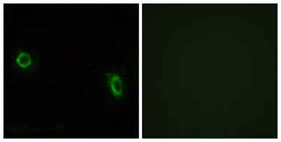 Olfactory receptor 6J1 rabbit pAb