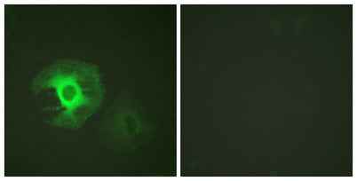 Caldesmon rabbit pAb