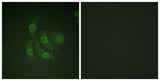 CaMKIV rabbit pAb 50µL/100µL