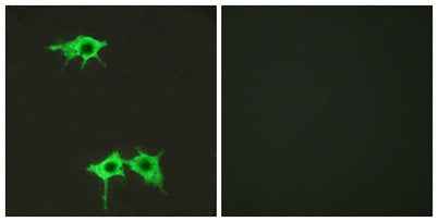 Frizzled-4 rabbit pAb