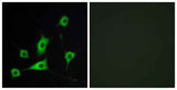 CRBP-III rabbit pAb