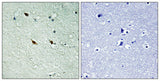 NIFK (phospho Thr234) rabbit pAb 50µL/100µL
