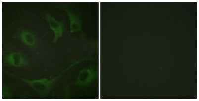 Cbl (phospho Tyr774) rabbit pAb