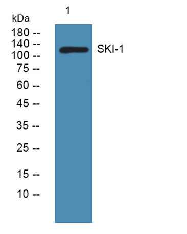 SKI-1 rabbit pAb