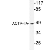 ACTR-IIA rabbit pAb