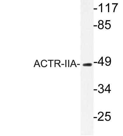 ACTR-IIA rabbit pAb