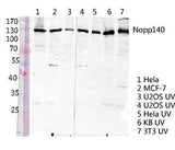 Nopp140 rabbit pAb