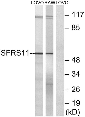 SFRS11 rabbit pAb 50µL/100µL