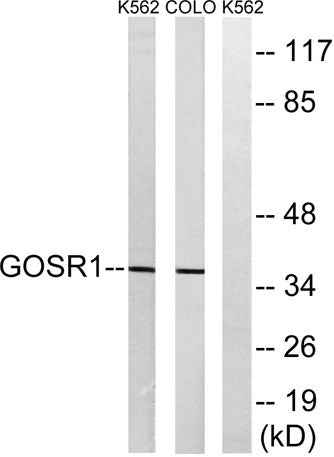 GS28 rabbit pAb