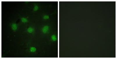 TLK1 rabbit pAb 50µL/100µL