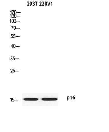 p16 rabbit pAb