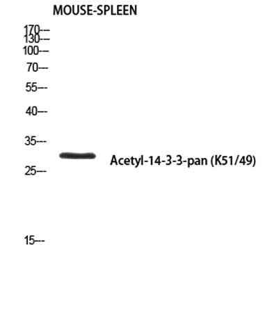 14-3-3-pan (Acetyl Lys51/49) rabbit pAb