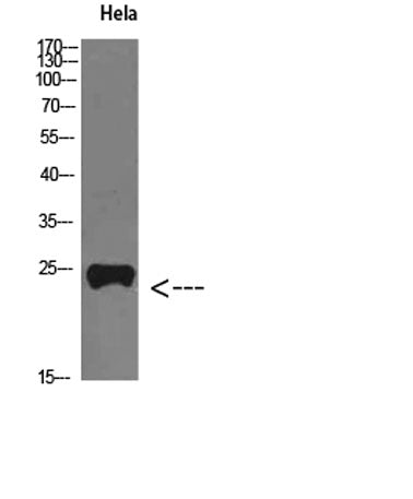 PTH-rP rabbit pAb 50µL/100µL