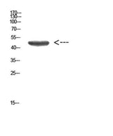 Cytokeratin 14/17 rabbit pAb