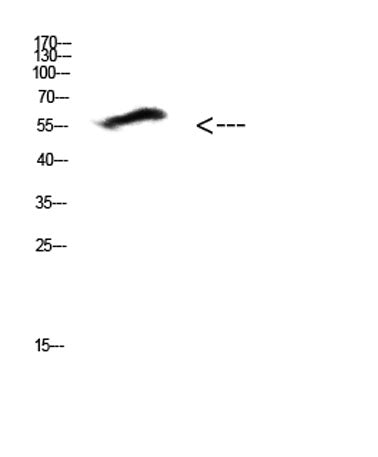 COL25A1 rabbit pAb 50µL/100µL