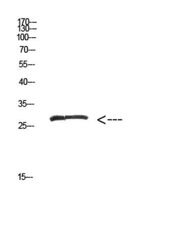 MYOZ2 rabbit pAb 50µL/100µL