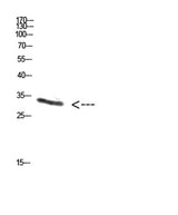 PENK rabbit pAb 50µL/100µL