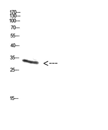 PENK rabbit pAb 50µL/100µL