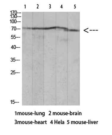 Ku-70 (Acetyl Lys317) rabbit pAb