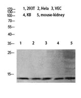 Histone H4 (Mono Methyl Lys21) rabbit pAb
