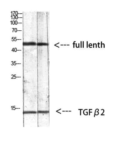 TGFβ2 rabbit pAb