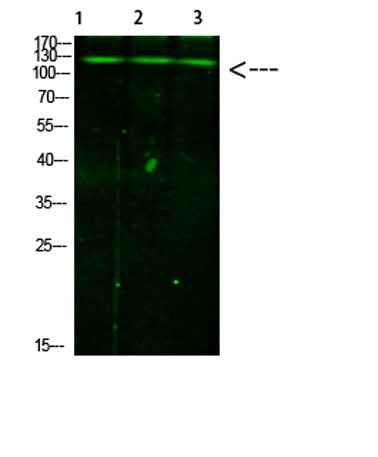 JAK2/3 (Phospho-Tyr966/939) Rabbit pAb