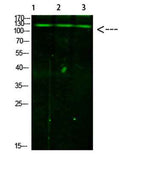 JAK2/3 (Phospho-Tyr966/939) Rabbit pAb