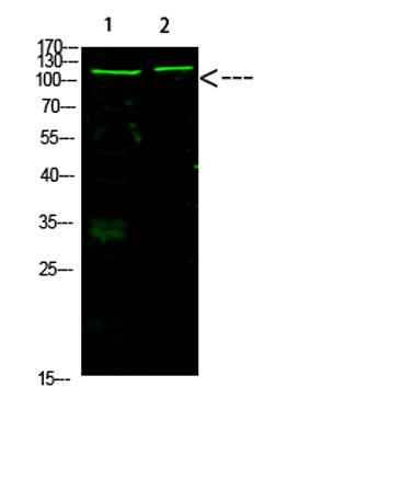 Rb (Acetyl-K873/K874) rabbit pAb