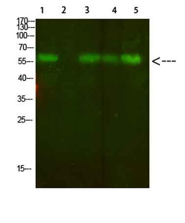 AVP Receptor V2 rabbit pAb