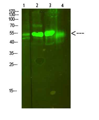 V-ATPase S1 rabbit pAb