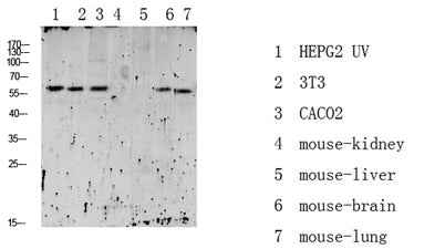 RIPK2 (Phospho-Ser176) Rabbit pAb