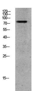 GRK2 (Phospho-Ser685) Rabbit pAb