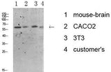 Tyrosine Hydroxylase rabbit pAb