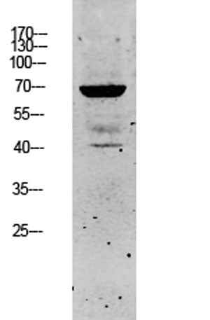 Keratin 5 rabbit pAb