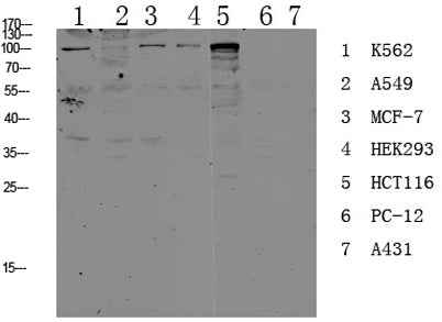 CDH17 rabbit pAb