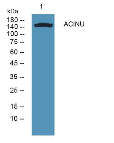 ACINU rabbit pAb