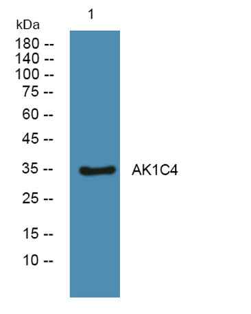 AK1C4 rabbit pAb