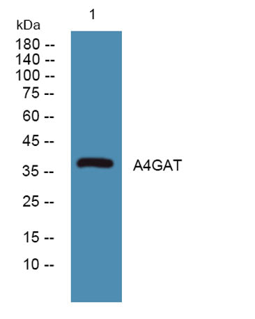A4GAT rabbit pAb 50µL/100µL