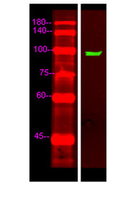 UNC5C rabbit pAb 50µL/100µL