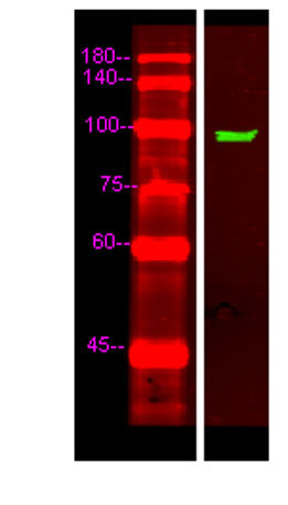 UNC5C rabbit pAb 50µL/100µL