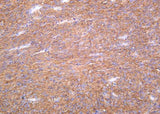Anti-Human TMEM16A Antibody [B1168]