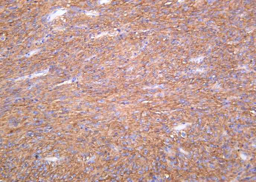 Anti-Human TMEM16A Antibody [B1168] - ABMIUM