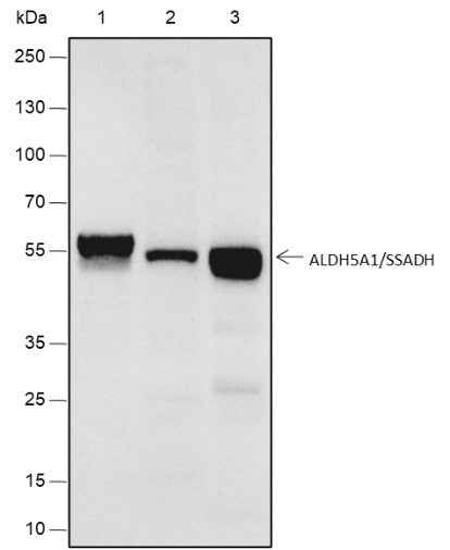 Anti-Human ALDH5A1/SSADH Antibody [A540] - ABMIUM