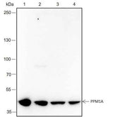 Anti-Human/Mouse PPM1A Antibody [A336]