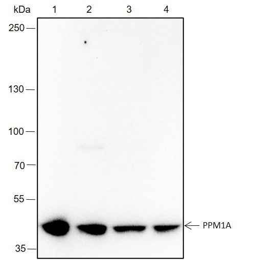 Anti-Human/Mouse PPM1A Antibody [A336]