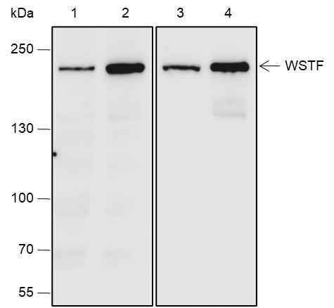 Anti-Human/Rat WSTF Antibody [A664]