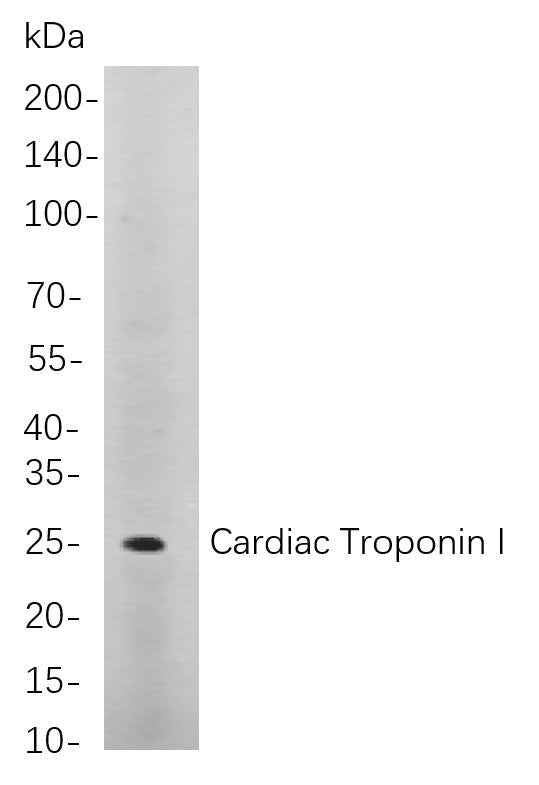 Anti-Human/Mouse/Rat Cardiac Troponin I Antibody [B839]